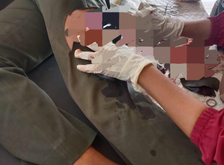 Dibacok Pencuri Kayu, Petugas Perhutani di Tuban&nbsp;Luka-luka